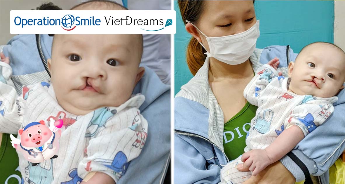 Quỹ Viet Dreams cùng cộng đồng Heo Đất trao tặng 80 ca phẫu thuật cho các bé hở môi, hàm ếch